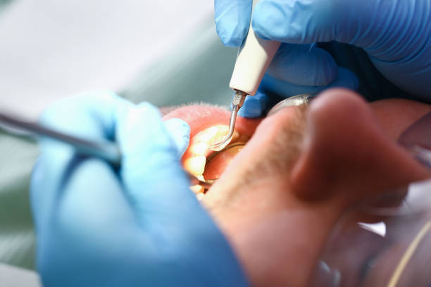 Best Emergency Treatment for Oral Infections in Manchester, TN