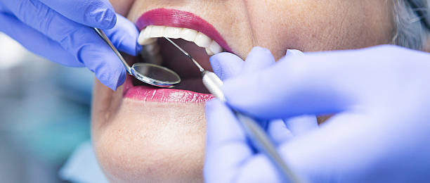 Best Knocked-Out Tooth (Avulsed Tooth) Treatment in Manchester, TN